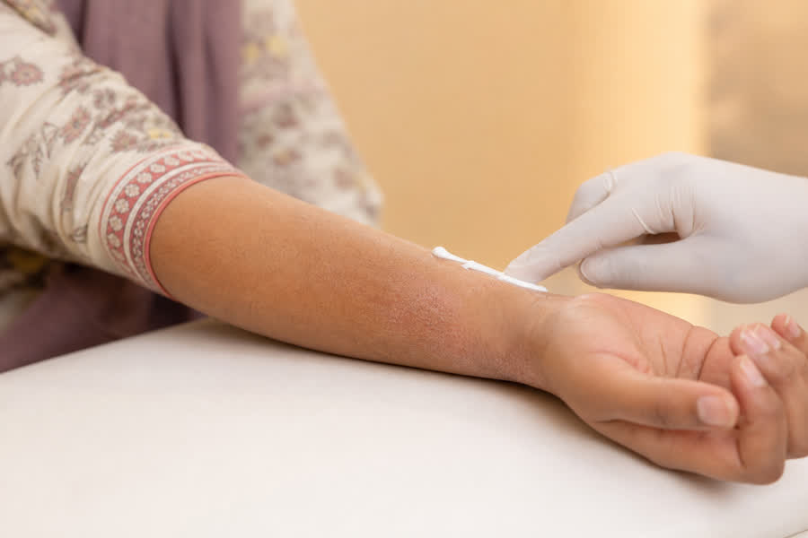 Eczema & Psoriasis